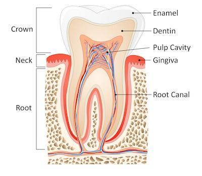 root canal graphic at dentist in st cloud fl