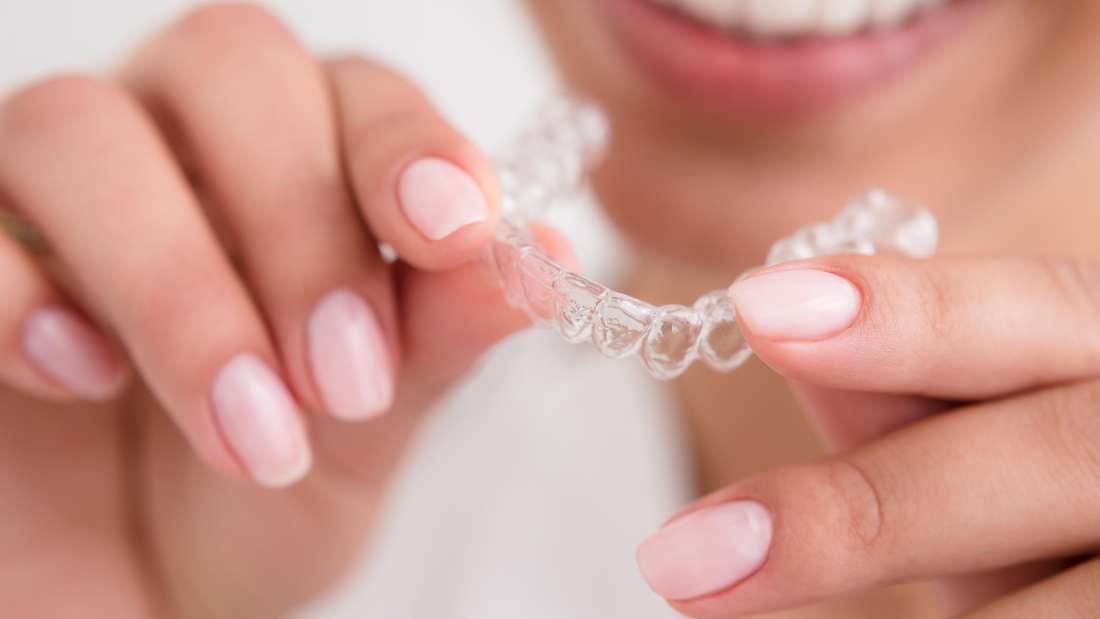 How to Compare the Cost and Effectiveness of Clear Aligners vs. Other